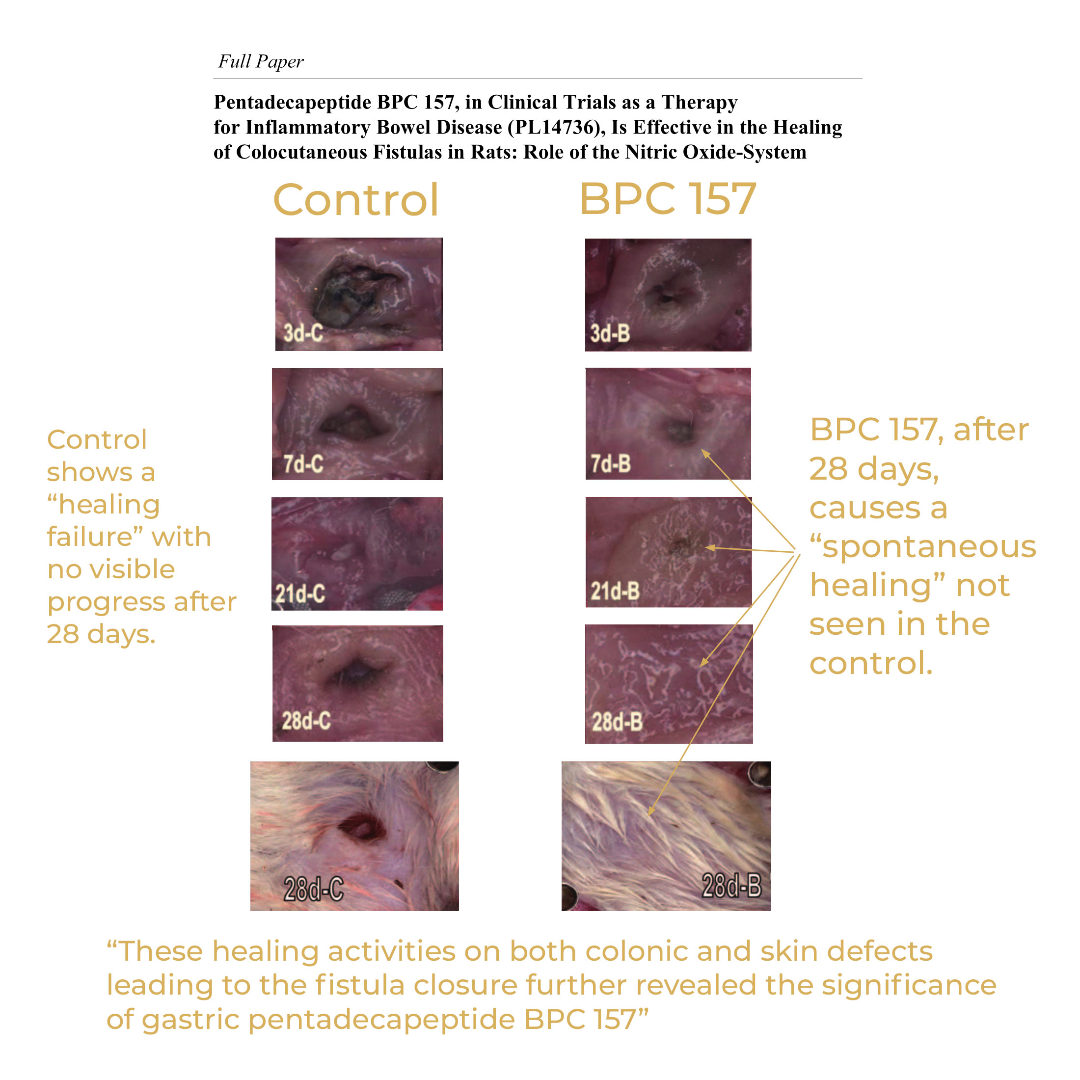 BpcNAC STABLE-BPC-157 + NAC